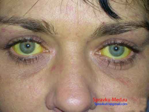 зараженнный гепатитом bc человек зараженнный гепатитом bc человек